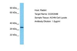 CCDC64B Rabbit anti-Human, Polyclonal, Novus Biologicals 0.1ml; Unconjugated:Antibodies,